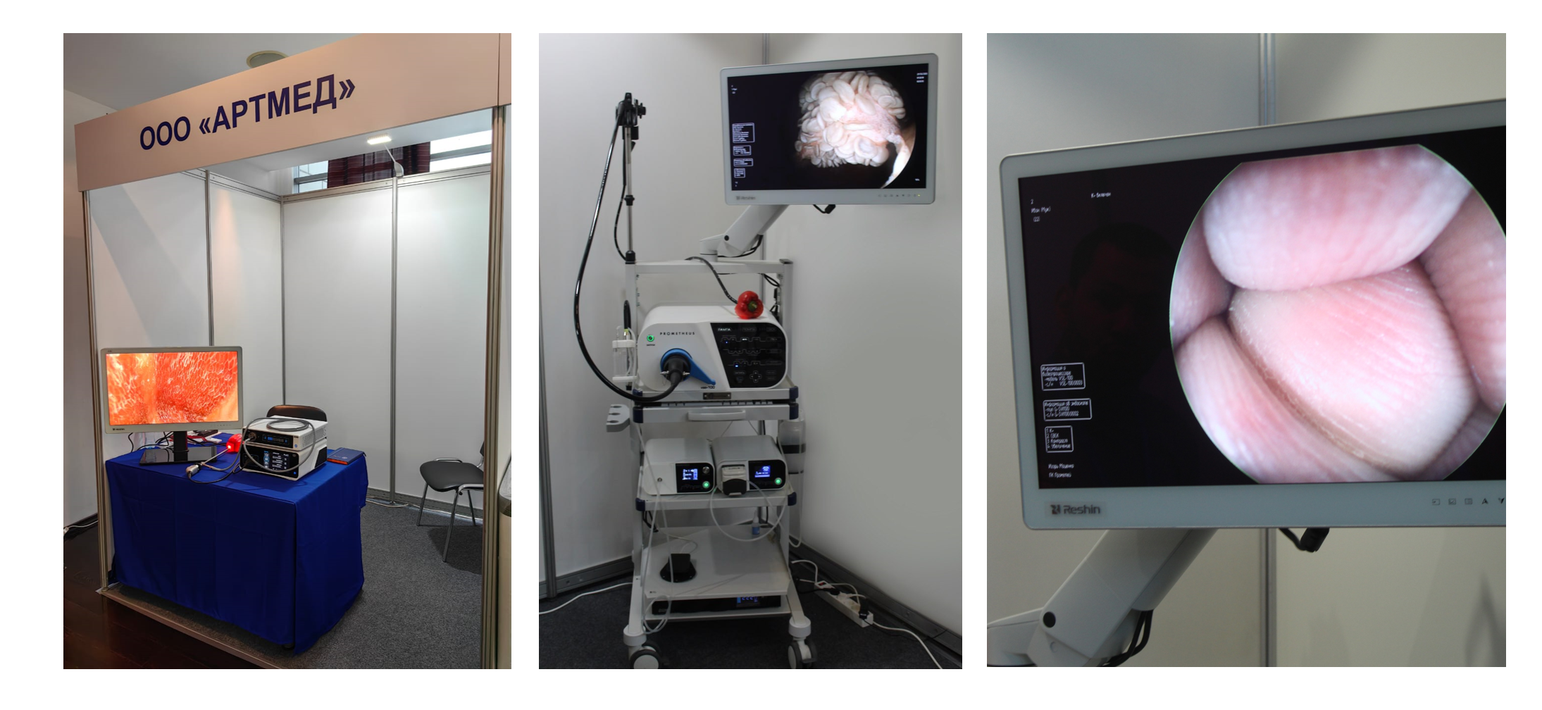 Актуальные вопросы эндоскопии