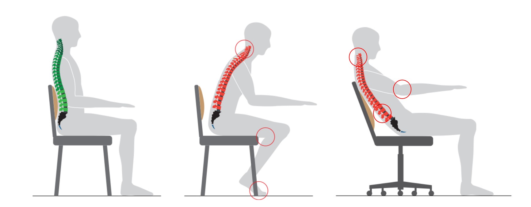изгиб позвоночника